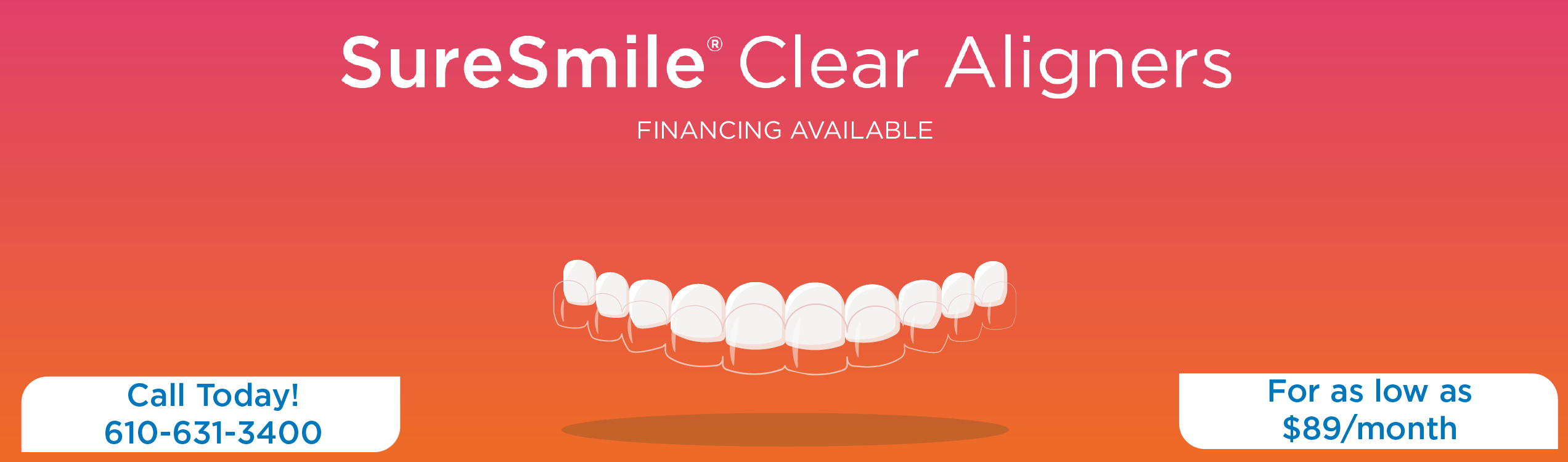 SureSmile Clear Aligner Therapy